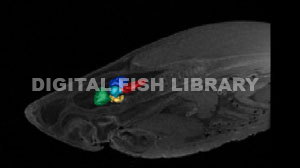 Great White Segmented Brain with MRI