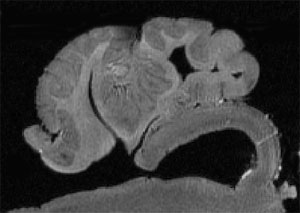 Brain Segmentation