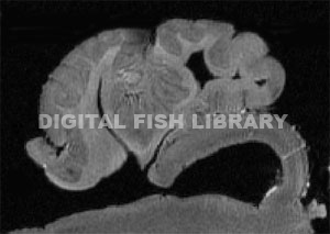 Brain Segmentation