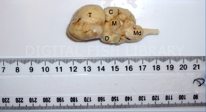 cerebellum and medulla