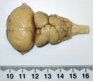 Dorsal brain