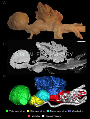 Brain of Whale shark